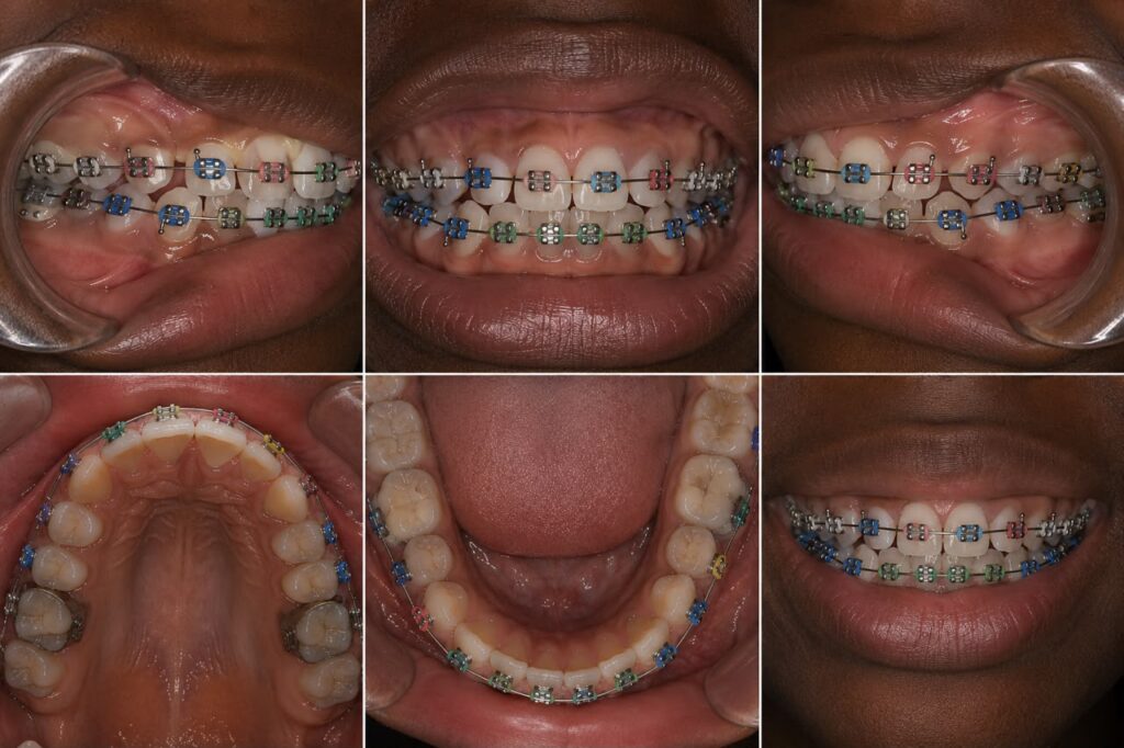 Orthodontie